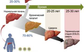 Лечение hcv. Лечение гепатита с в домашних условиях медикаментами