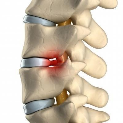 Почему может болеть спина и пах