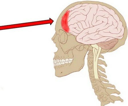Если несколько дней болит голова в лобной части