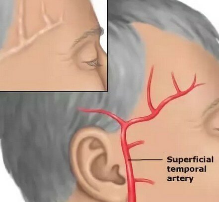 Болит правый висок головы почему что делать как
