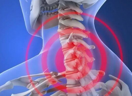 голова болит около шеи