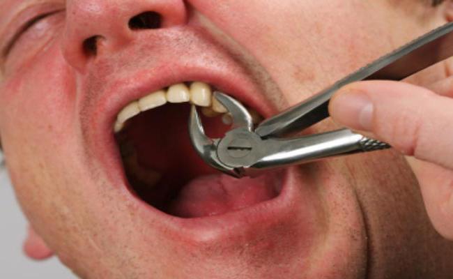 болит зуб и голова с одной стороны