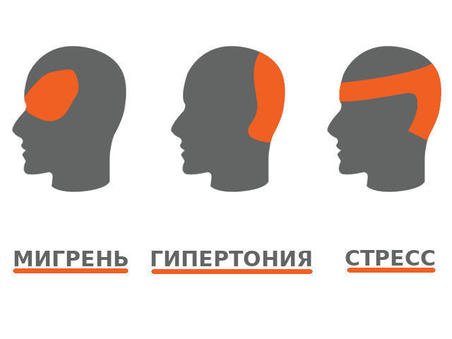 Болит голова что делать если нет лекарств