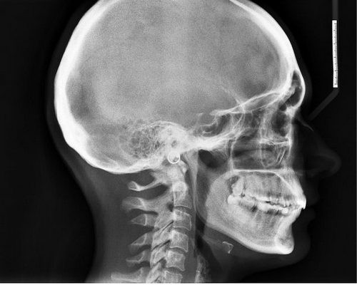 Болит голова как только встаю