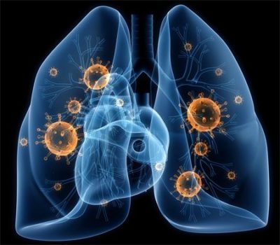 Что может болеть справа в боку и отдавать в спину