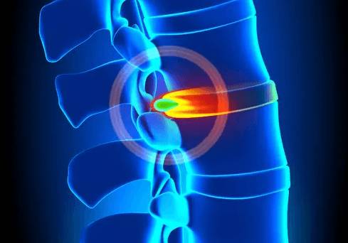 болит спина в области шеи и левой лопатки