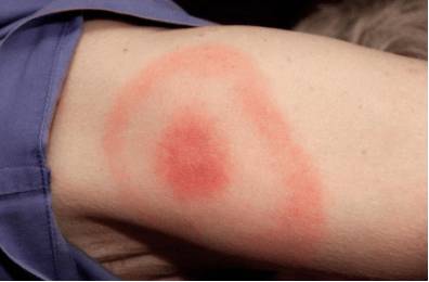 Почему у человека слабость болит голова