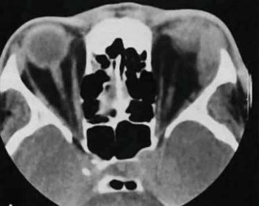У меня болит спина и температура