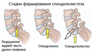 Болит спина в области поясницы по ночам причины