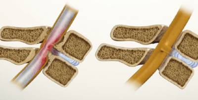 Почему может болеть спина и пах