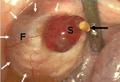 В середине цикла болит низ спины что это