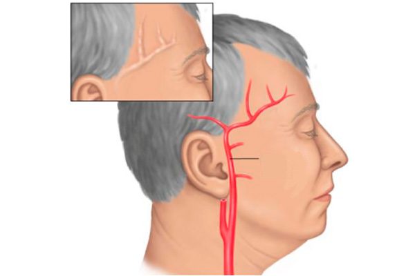 Болит макушка головы таблетки не помогают