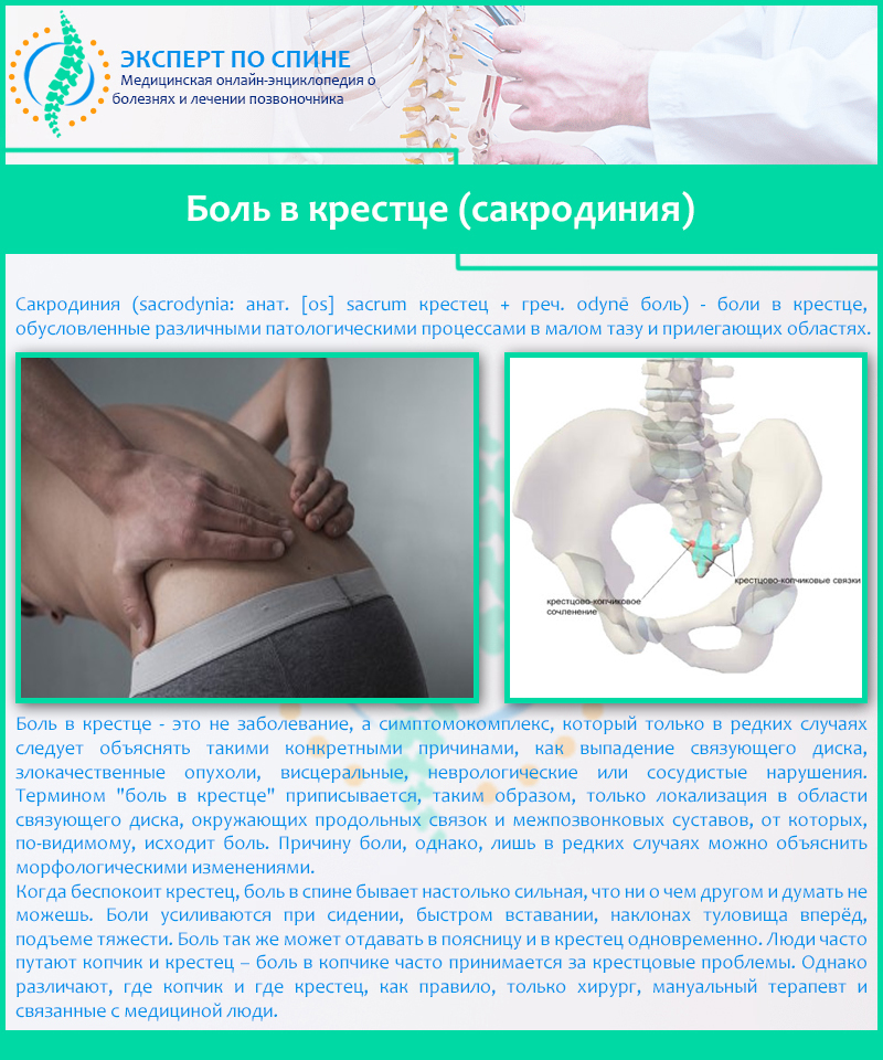 Боль в крестце (сакродиния)