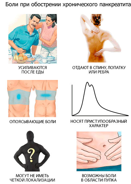 Боли при обострении хронического панкреатита
