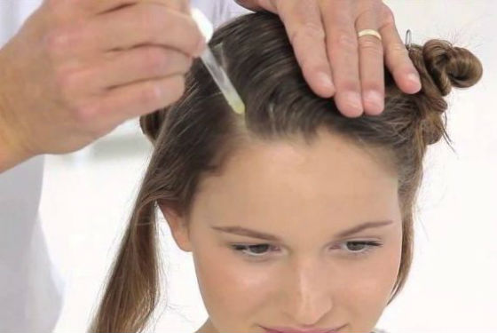 Лечение болезненности кожи головы медикаментозными препаратами