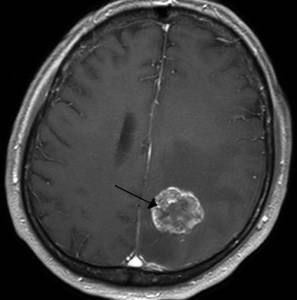 Почему у человека слабость болит голова