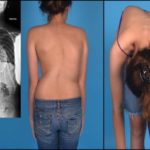 болит грудь в середине и спина