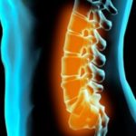 Болит спина как вправить